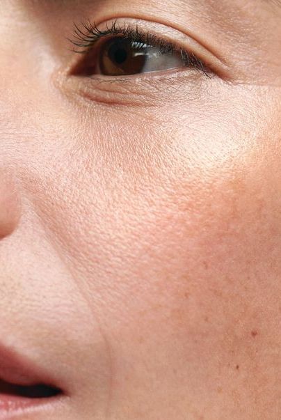Da xỉn màu, thiếu sức sống