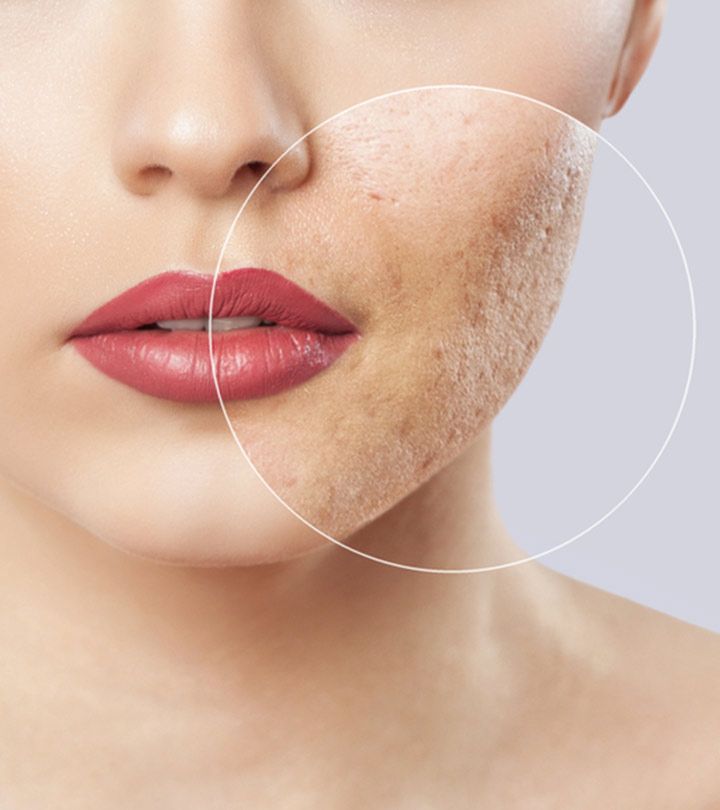 Một làn da thiếu nước không đủ độ mịn để giữ lớp nền ổn định.